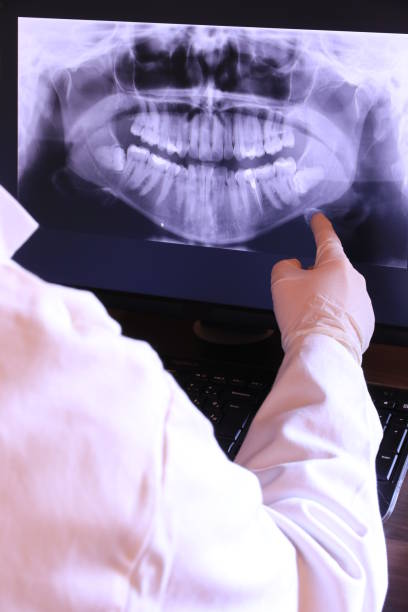 Best Emergency Dentist for Lost Fillings or Crowns in Menands, NY
